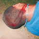 A photo of a teen, identified only as D.B., taken after the reported beating he suffered at the hands of Grand Rapids, Mich., police June 13, 2014
WZZM screenshot